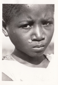 Fotografie dítěte s neštovicemi, Kongo, 60. léta
