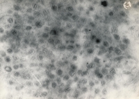 Viral particles after centrifugation, ca. 1966